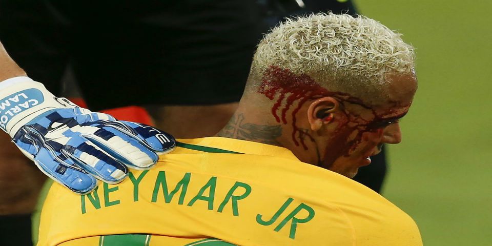 Video: golpean a Neymar y lo dejan sangrando