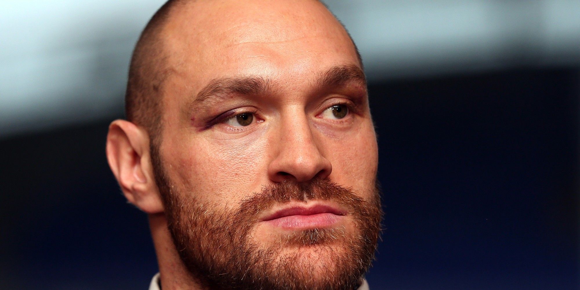 “Espero que alguien me mate antes de que me mate yo”: Tyson Fury - o-TYSON-FURY-facebook
