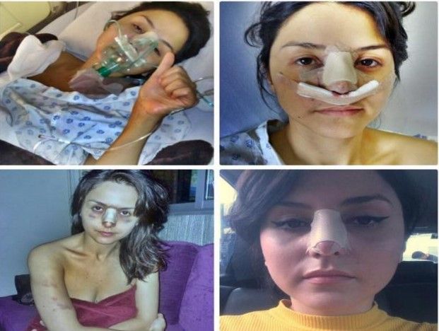 Mujer termina hospitalizada tras golpiza de Sabu Avilés - sabu-4