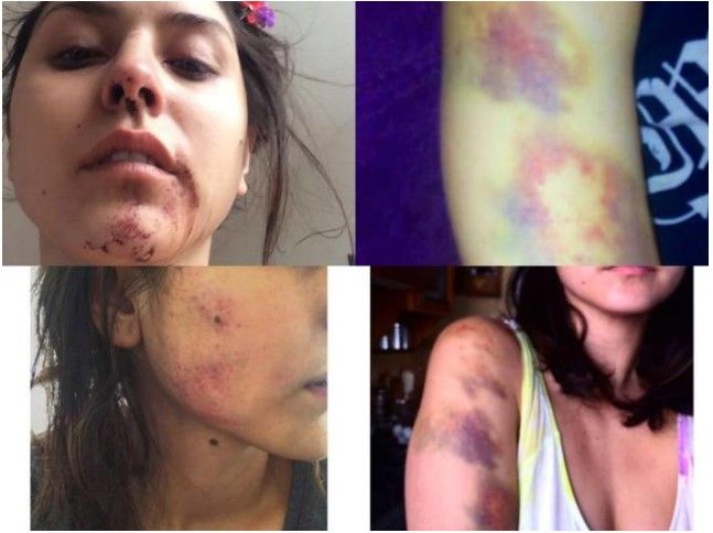 Mujer termina hospitalizada tras golpiza de Sabu Avilés - sabu-5