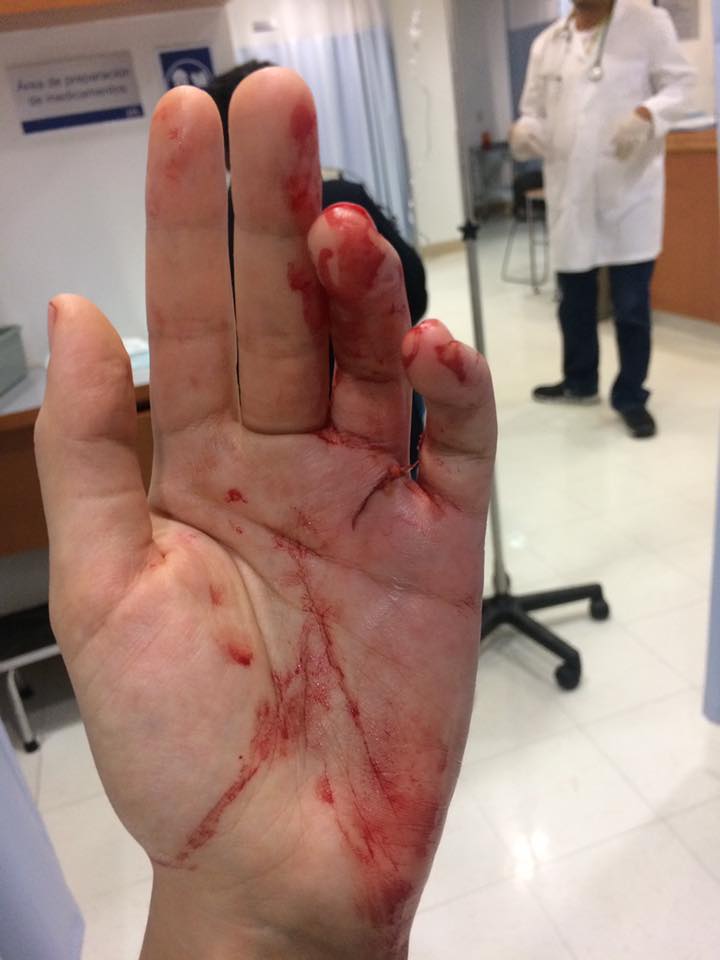 Automovilista ataca con bastón de seguridad a mujer en Patriotismo - 15056504_1319023151476238_2012785396614046027_n