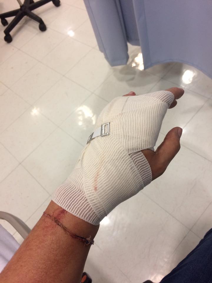 Automovilista ataca con bastón de seguridad a mujer en Patriotismo - 15078867_1319023188142901_2709384358168583557_n