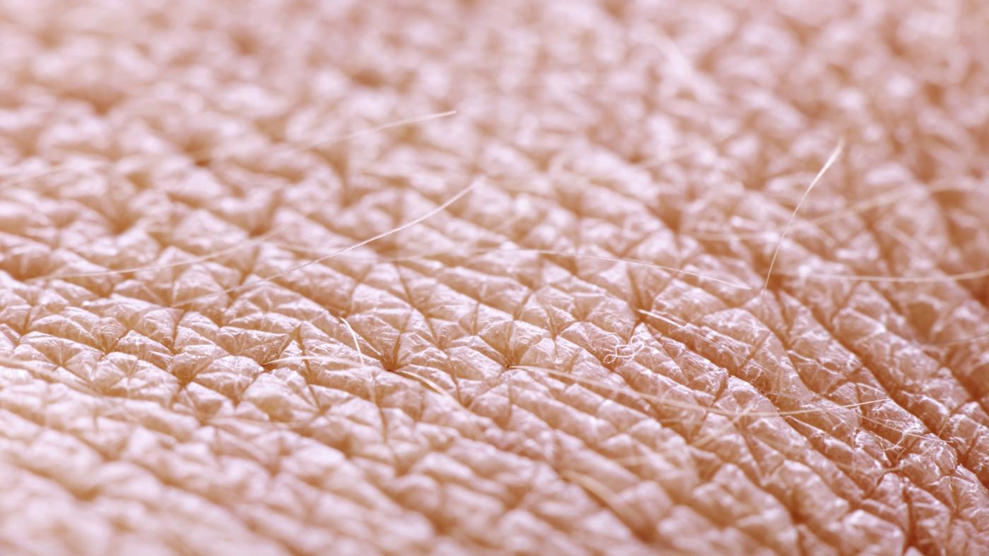 ¿Qué hacer en caso de sufrir alguna quemadura?