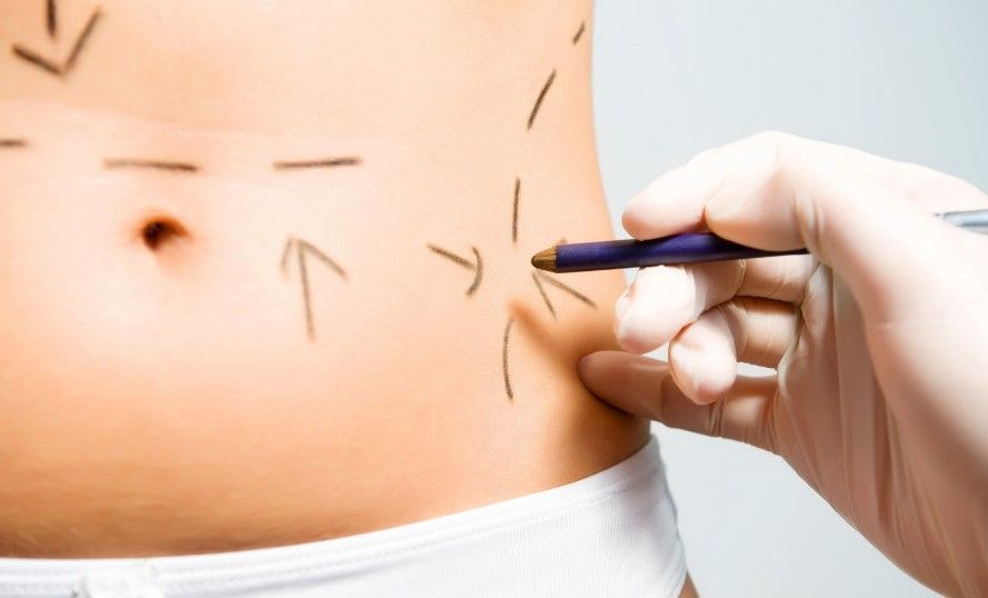 Exigirán certificado profesional a cirujanos estéticos - cirugía