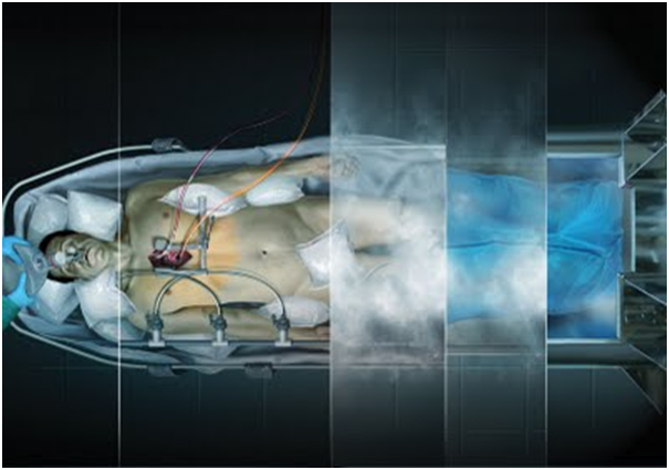 Congelan cuerpo de adolescente británica y lo envían a EE.UU. - criogenia