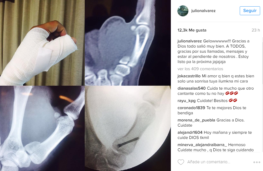 Toro fractura la mano de Julión Álvarez - julion-alvarez