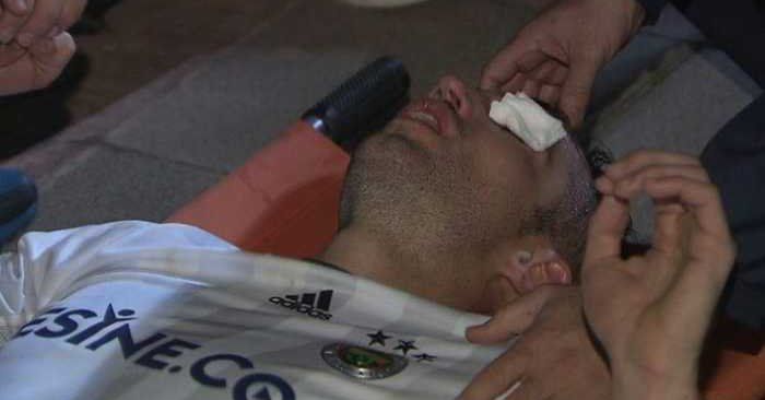 Video: la lesión que casi le cuesta un ojo a Robin van Persie - van-persie