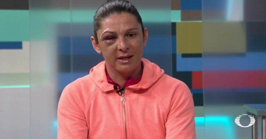 Vinculan a proceso a agresor de Ana Guevara