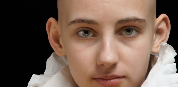 Una visión conjunta sobre el cáncer y el ejercicio - cancer3