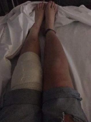 Estampida deja 80 heridos en festival musical en Australia - dbf0776fc9fdc646ce42883ab0a268e8