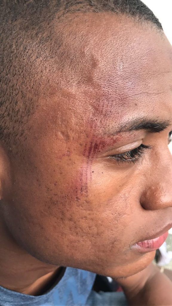 Video: futbolista colombiano pelea con la policía - fabio-burbano-1-576x1024