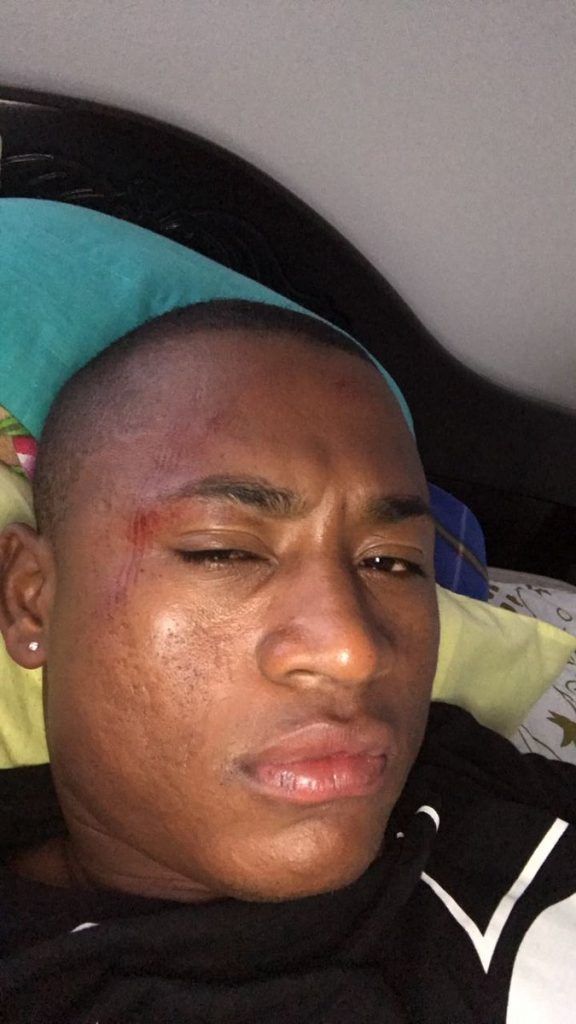 Video: futbolista colombiano pelea con la policía - fabio-burbano-2-576x1024