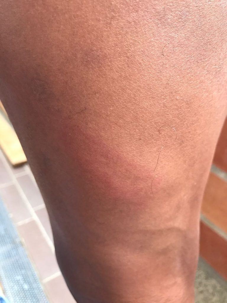 Video: futbolista colombiano pelea con la policía - fabio-burbano-3-768x1024