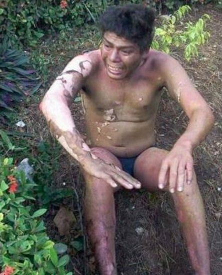 Prenden fuego a un indigente en Chiapas - indigente-chiapas