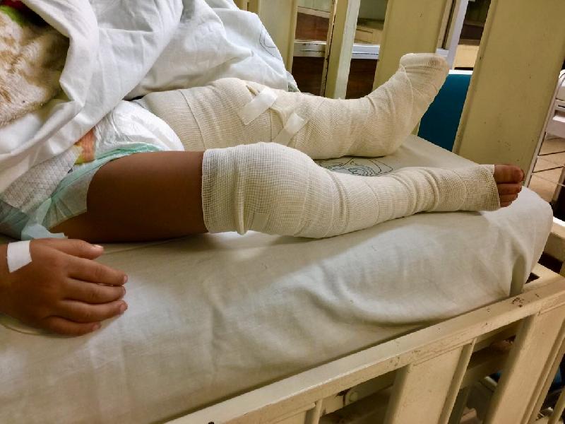 Perro ataca a niño de dos años en Coahuila