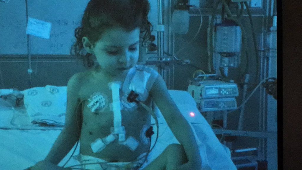 Trasplantan corazón a menor de 4 años en México - transplante-corazon-menor-1024x576