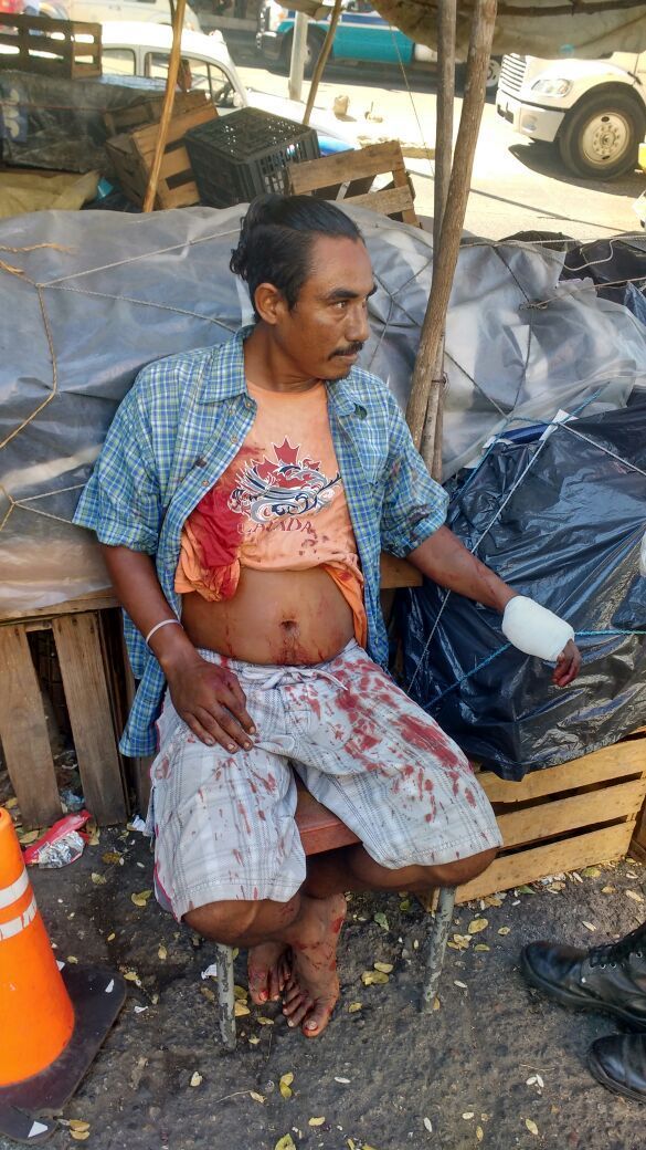 Balacera en Acapulco deja a una menor muerta y a un hombre herido - 21f4af98-5e60-4b69-b46e-c9fb5d6239a8