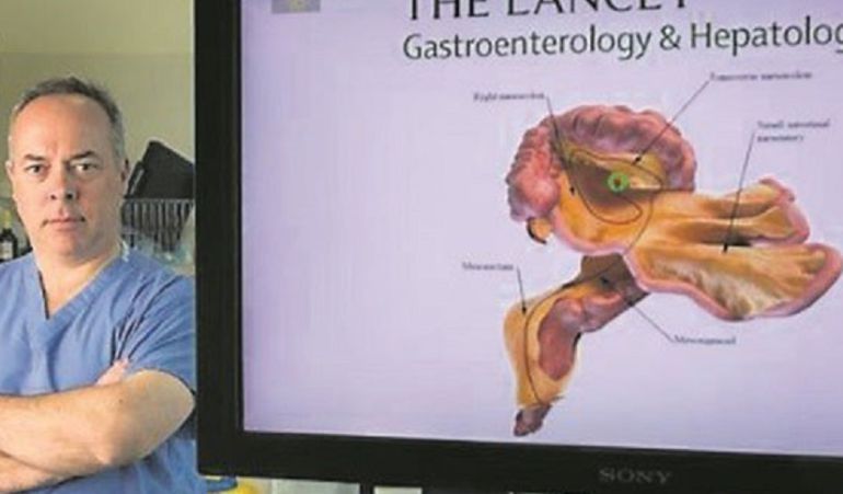 Identifican nuevo órgano en el cuerpo humano