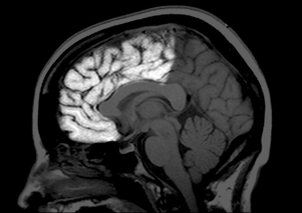Científicos revelan la edad a la que madura el cerebro humano - cerebro-maduración-e1483550463234-1024x722