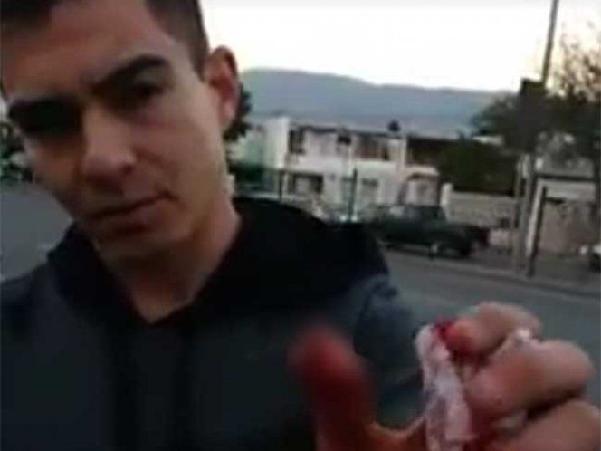 Video: arrancan dedo a automovilista en Nuevo León