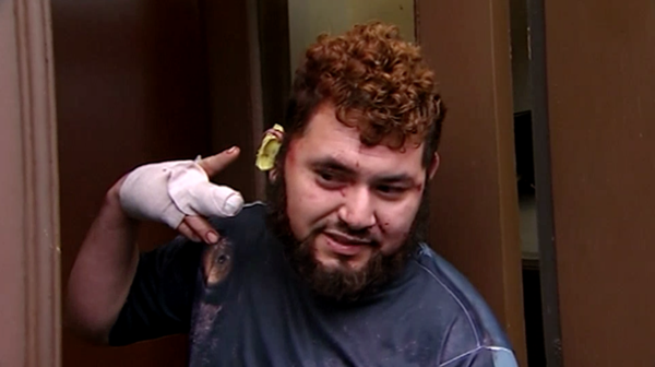 Hombre arranca oreja a mexicano tras discutir sobre Trump - mexicano-oreja-trump-2