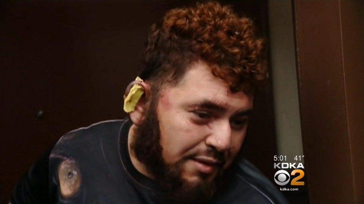 Hombre arranca oreja a mexicano tras discutir sobre Trump Hombre arranca oreja a mexicano tras discutir sobre Trump