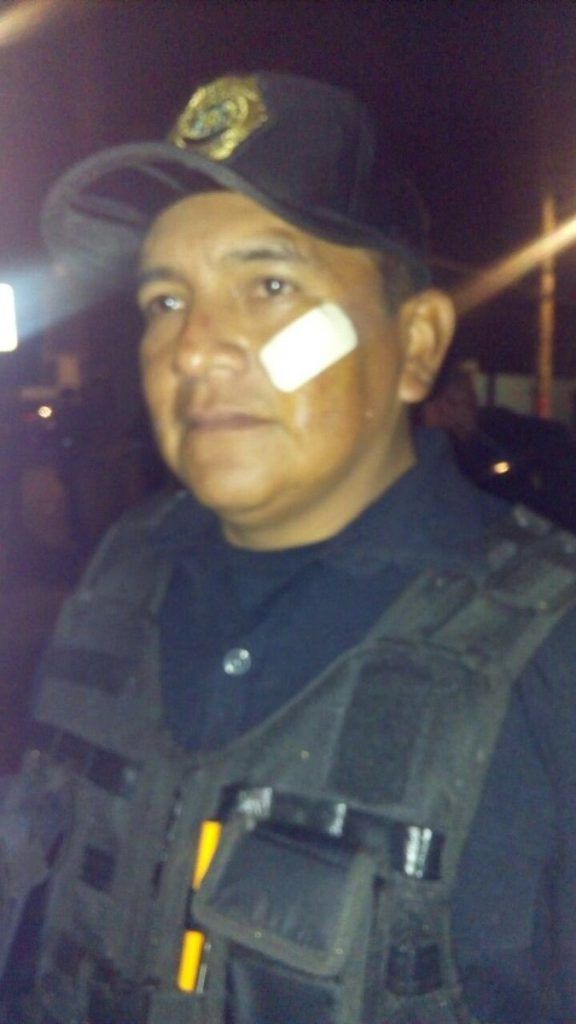 Enfrentamiento en Culhuacán deja 13 heridos y seis detenidos - operativo-2-ssp_cdmx-576x1024