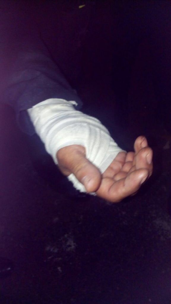 Enfrentamiento en Culhuacán deja 13 heridos y seis detenidos - operativo-3-ssp_cdmx-576x1024