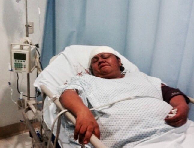 Por evitar saqueo en Sanborns, mujer policía sufre fractura de cráneo - policía-herida-I