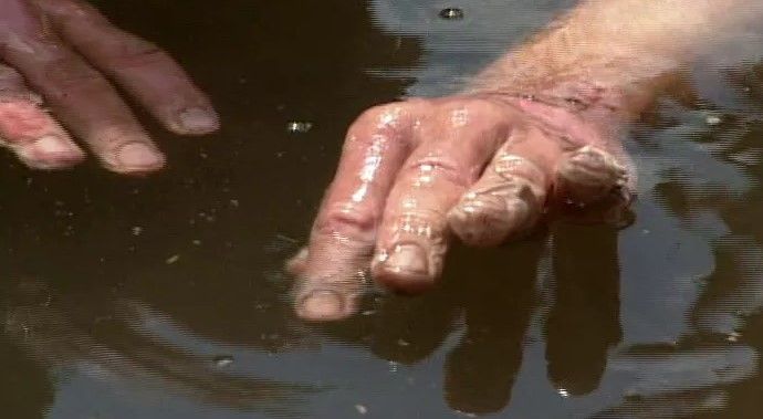 Exconcursante de "Survivor" condenado a prisión por pornografía infantil - quemadura-de-manos