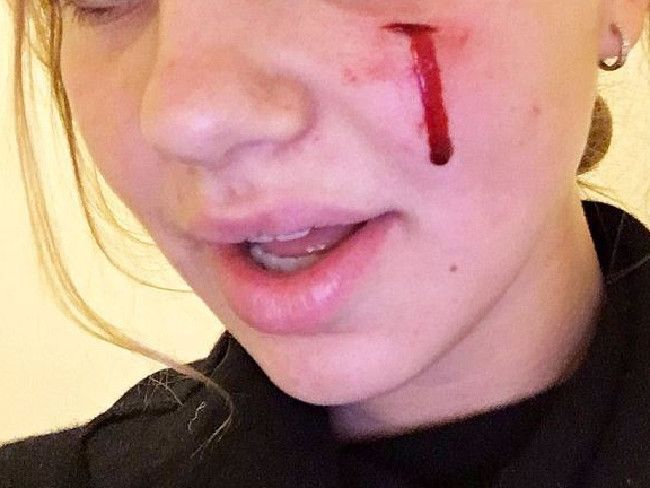 Sunny, perro de los Obama, muerde a joven en el rostro - sunny-obama-bites