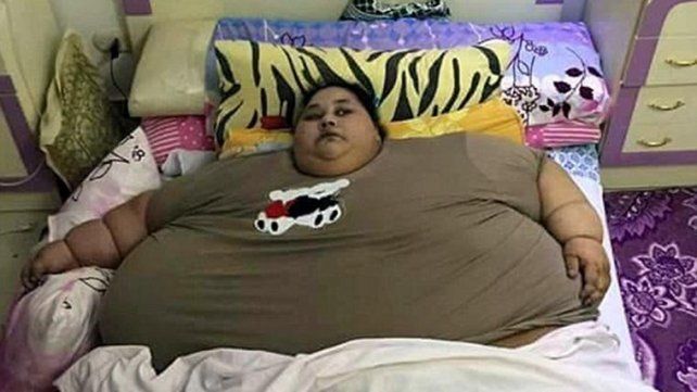 Operarán a la mujer más obesa del mundo