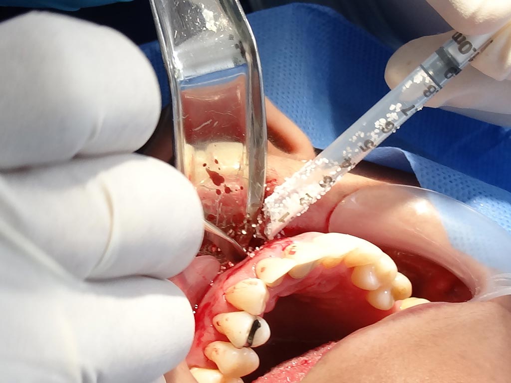 Recomiendan medidas para evitar enfermedades contagiadas por el beso - brialdent