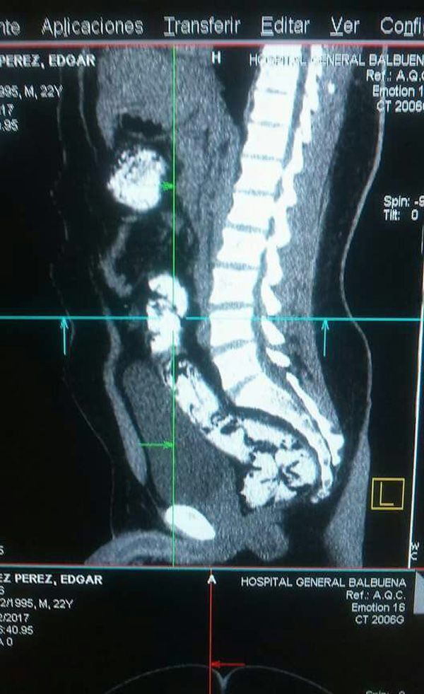 Detienen a sujetos que transportaban cocaína en el AICM - droga-aicm-peru-2