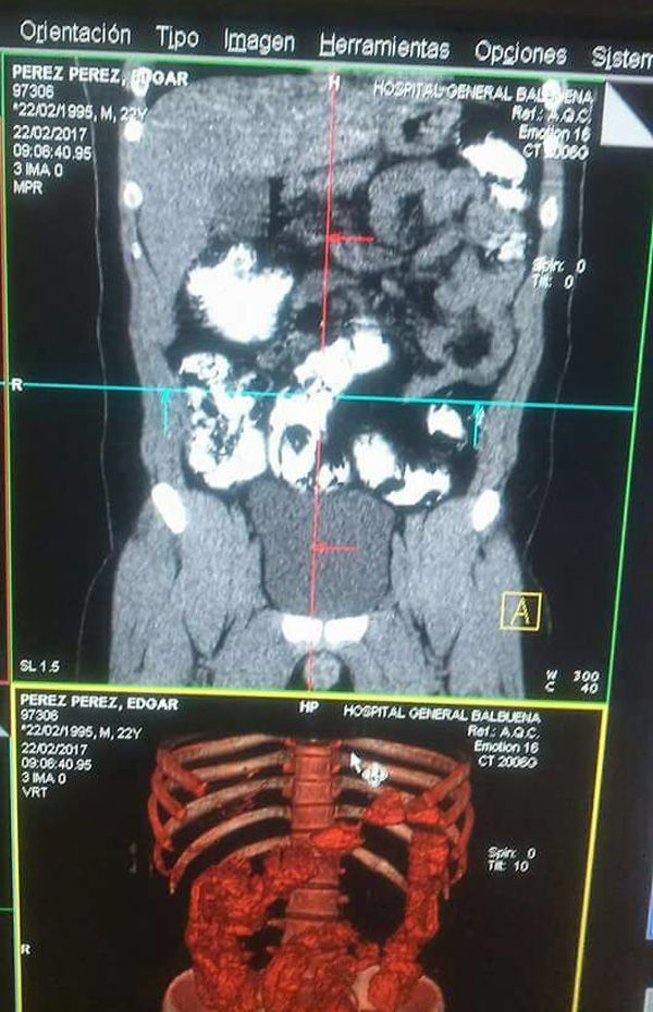 Detienen a sujetos que transportaban cocaína en el AICM - droga-aicm-peru-3
