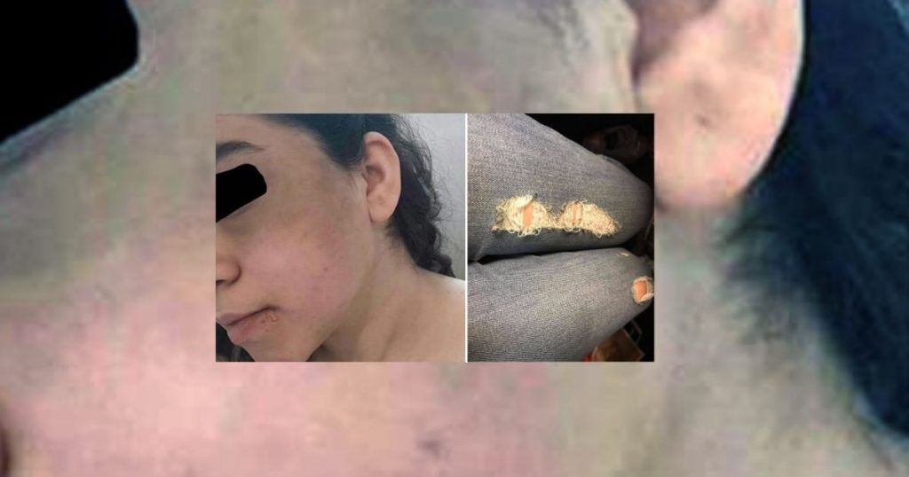 Detienen a menor iraní por usar pantalones rasgados - golpes-menor-1024x538