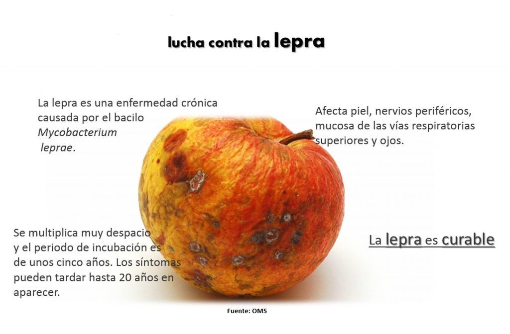 La enfermedad que continúa presente en el mundo tras cuatro mil años - lepra-1024x672