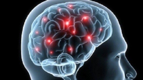 Diez maneras de reducir las probabilidades de sufrir un ataque cerebral