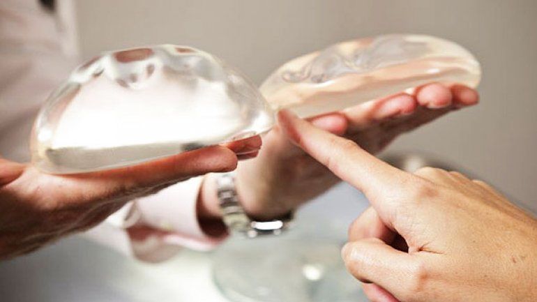 Reportan muertes por cáncer asociado a implantes mamarios