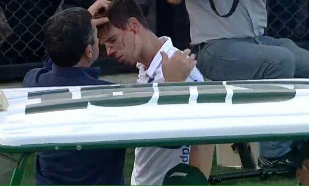 Futbolista rompe nariz a compañero durante festejo