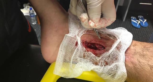 Tuzos alcanzan liderato y quedan preocupados por "Chucky" Lozano - chucky_lozano-entrada