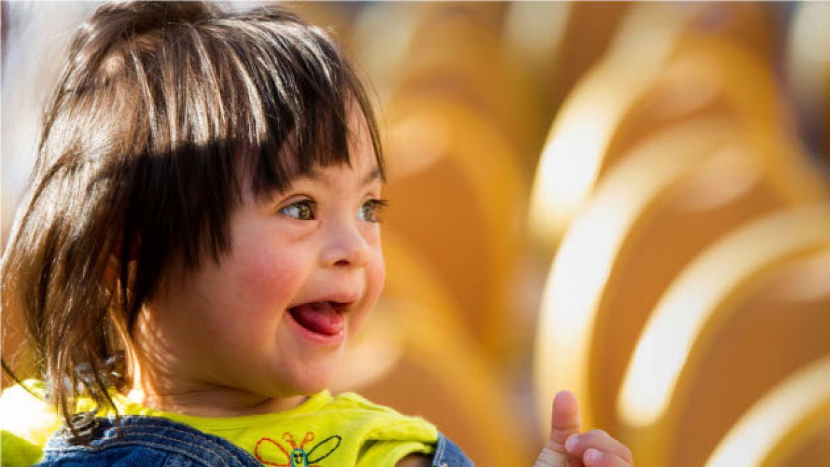 Ciudad de México tendrá clínica especializada en síndrome de Down