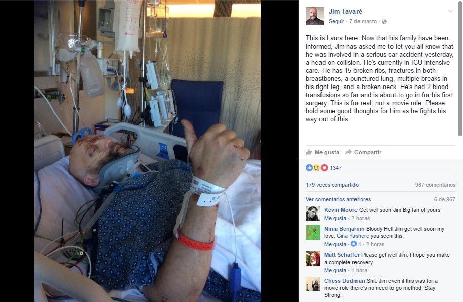 Actor de Harry Potter sufre fuerte accidente vial - jim-tavaré