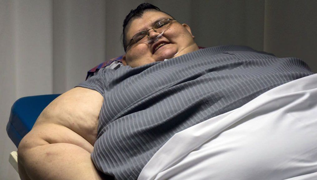 Podrán operar al hombre más obeso del mundo