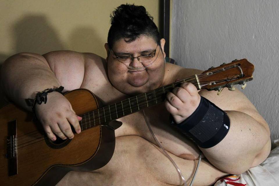 Podrán operar al hombre más obeso del mundo - juan-pedrroo