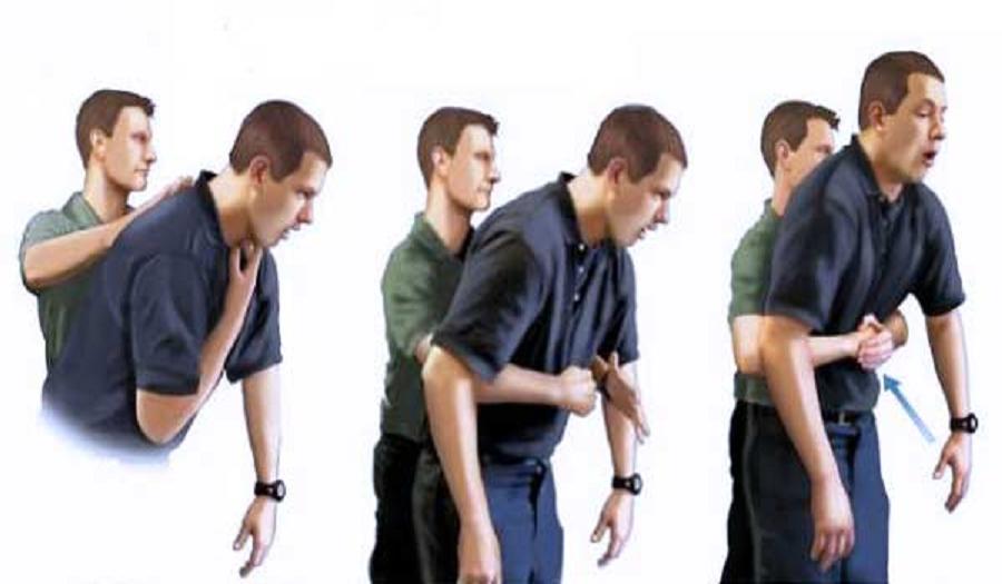 #Video Policía rescata con maniobra de Heimlich a compañera - maniobra-de-heimlich