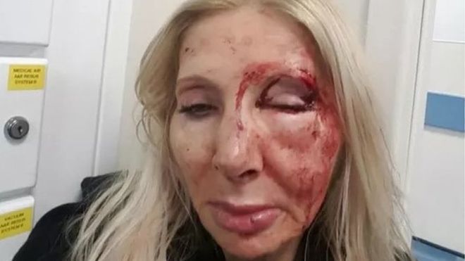 Golpea a mujer porque no quiso hablar con él - mujer-1