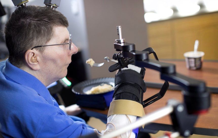 Hombre con cuadriplejía recupera movilidad de brazos y manos