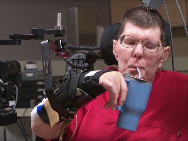 Hombre con cuadriplejía recupera movilidad de brazos y manos - tetraplejico