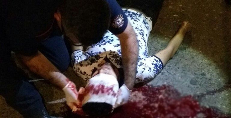 Ejecución de hombre deja siete heridos en Acapulco - Ataque-Acapulco-1